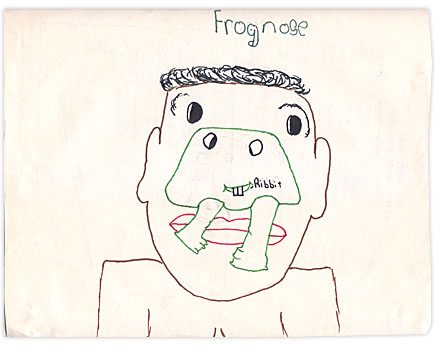 Humor, Horror, and Heavy Metal: Frognose - A Disease of Humiliation. There's a frog. Coming out of my NOSE. A frickin' FROG... NOSE.